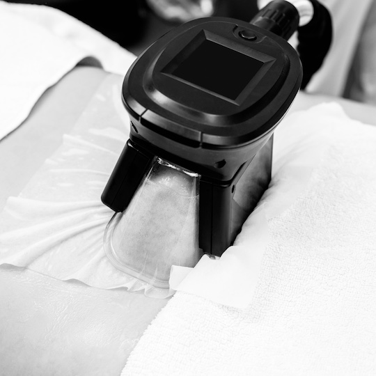 BDM Beauty Lounge Kryolipolyse